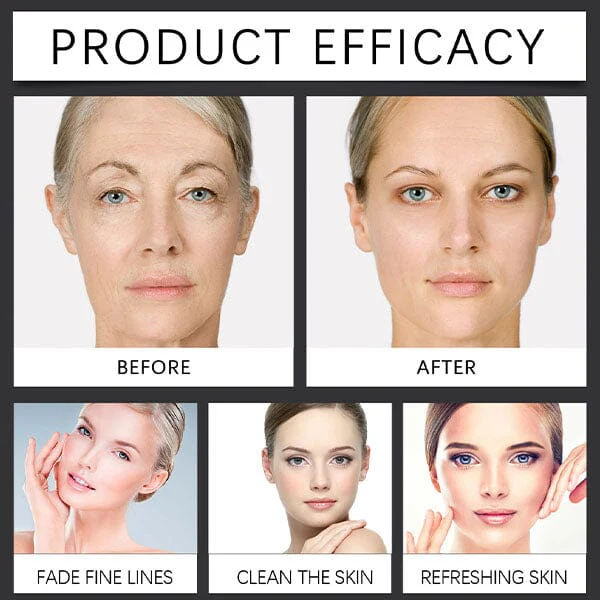 KojicLux Kojic Acid & Turmeric Root Facial Serum (30mL) - Image 3