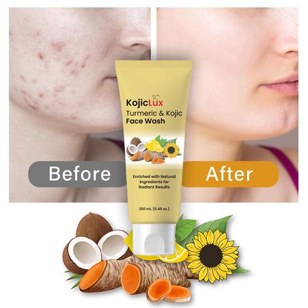 KojicLux Kojic Acid & Turmeric Face Wash Facial Cleanser (250mL) - Image 4